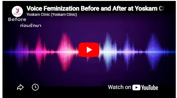 Voice Feminization