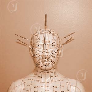 Acupuncture for depression