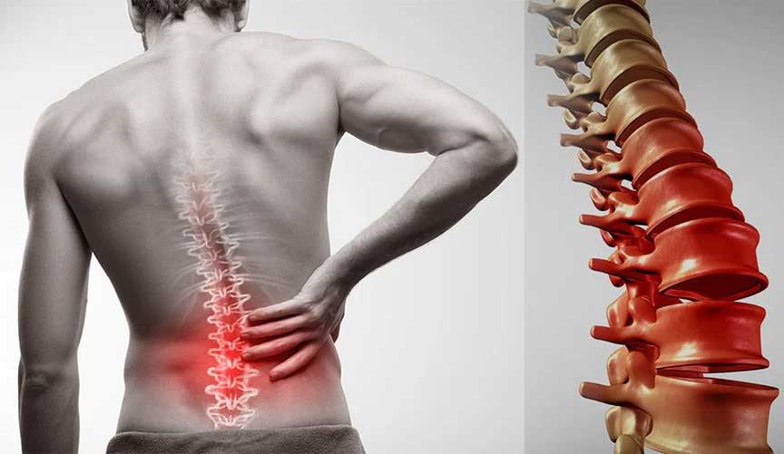 Acupuncture Solutions for Lower Back Pain