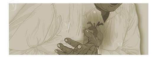 Acupuncture for Angina